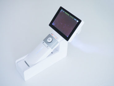 Digitální dermatoskop